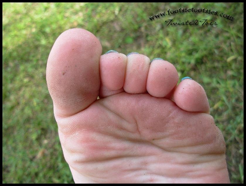 Cover 5 Twisted Toes 24 Photos